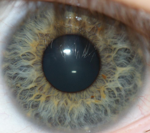 iris recognition